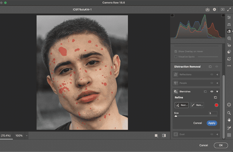 Figure 3. Clicking the Refine button reveals the found blemishes, which you can edit with the Refine brushes.